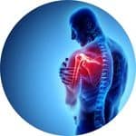 Frozen Shoulder